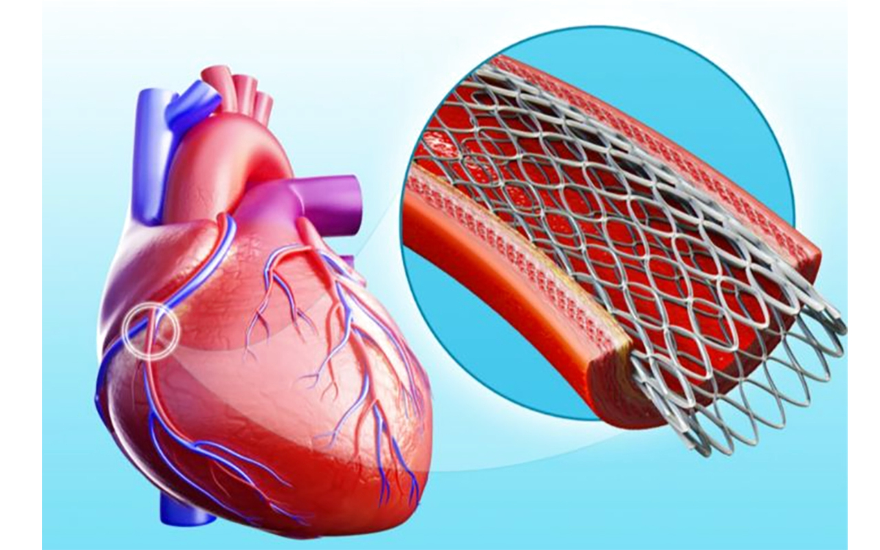 image - 2022-05-23T075003.027