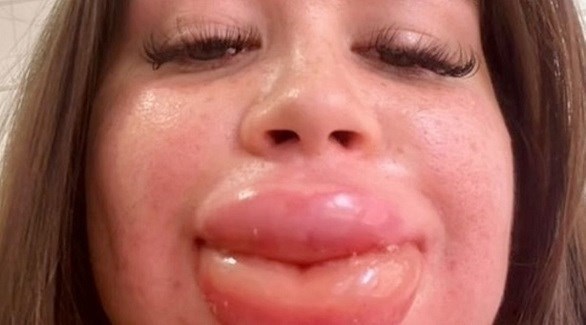 202283019058536I