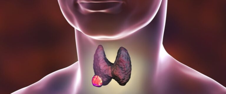 sabq_2024-02_1ee1626a-a9a3-4152-b710-a05560a86ccd_tbl_diseases_disease_54_871bba890c9_cae5_4170_9028_4a0ddf7b6d90