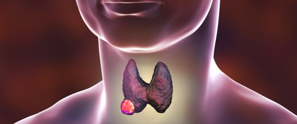 sabq_2024-02_1ee1626a-a9a3-4152-b710-a05560a86ccd_tbl_diseases_disease_54_871bba890c9_cae5_4170_9028_4a0ddf7b6d90