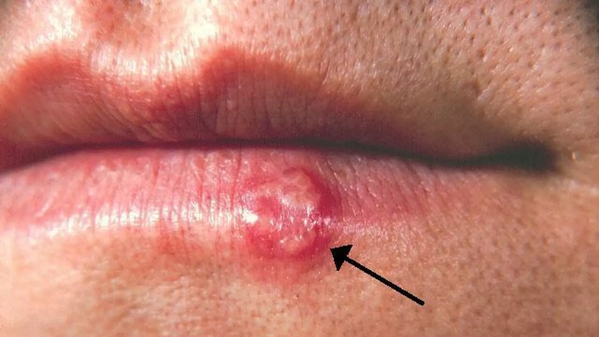 sabq_2024-02_b423b3dd-4fe4-458c-a0b5-becaeb0fdabe_1086223633_0_0_642_361_1920x0_80_0_0_af23bb526a934a199b6a0a9389075eaf_jpg