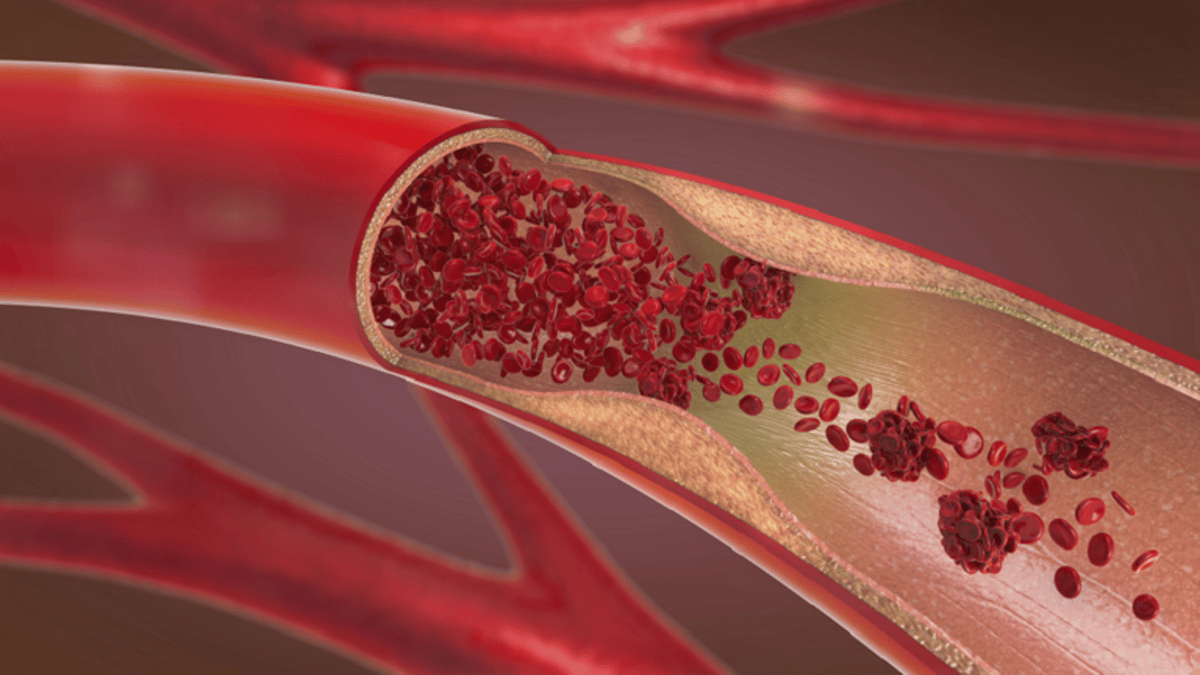 sabq_2024-04_3b5d2055-03ce-4ef7-a255-948e7bc838d9_662676194c59b746b504f207