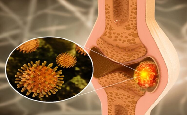 sabq_2024-07_d1a7de5e-ca06-4285-a12a-43a80c1fd247_4